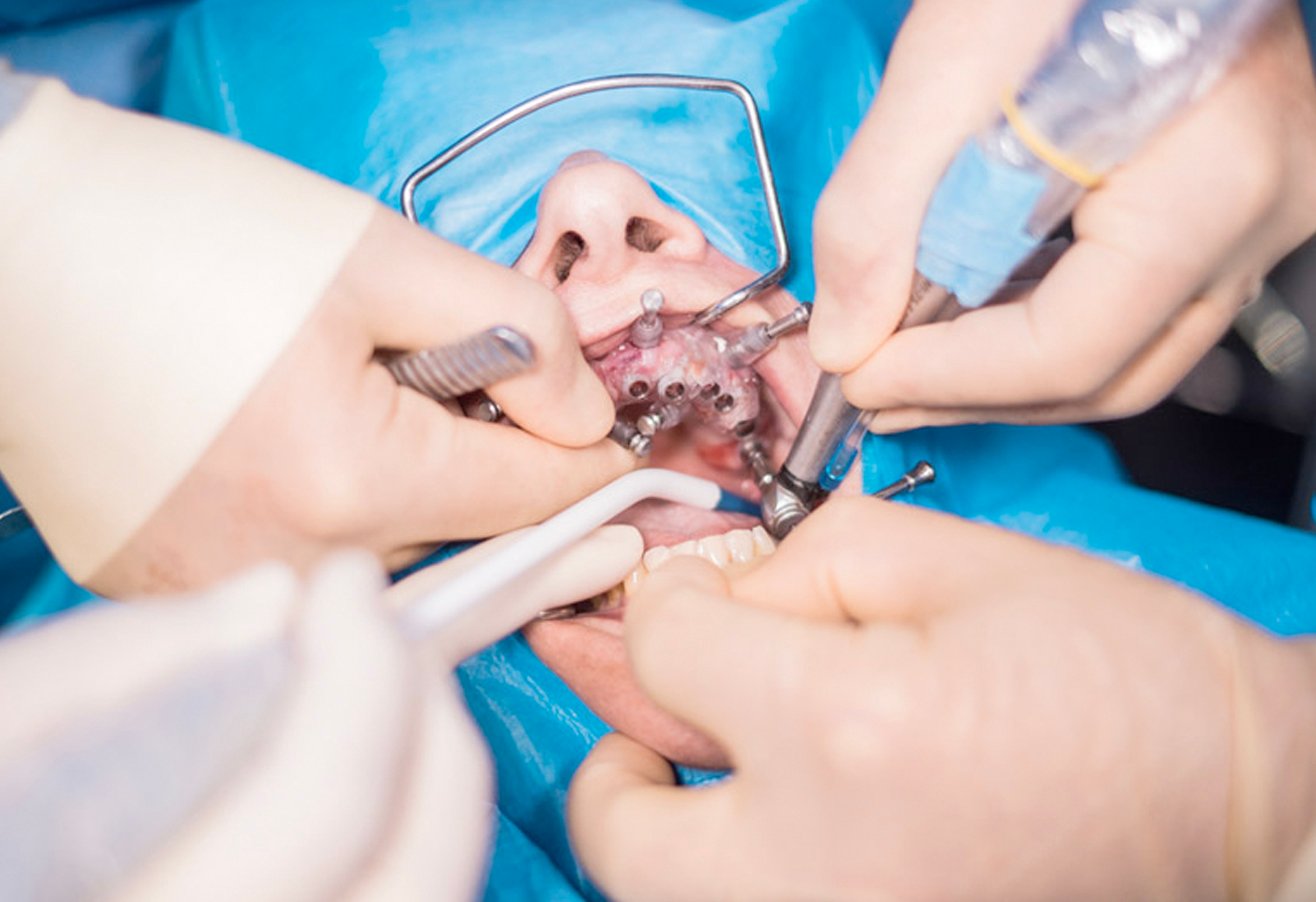 Oral Surgery